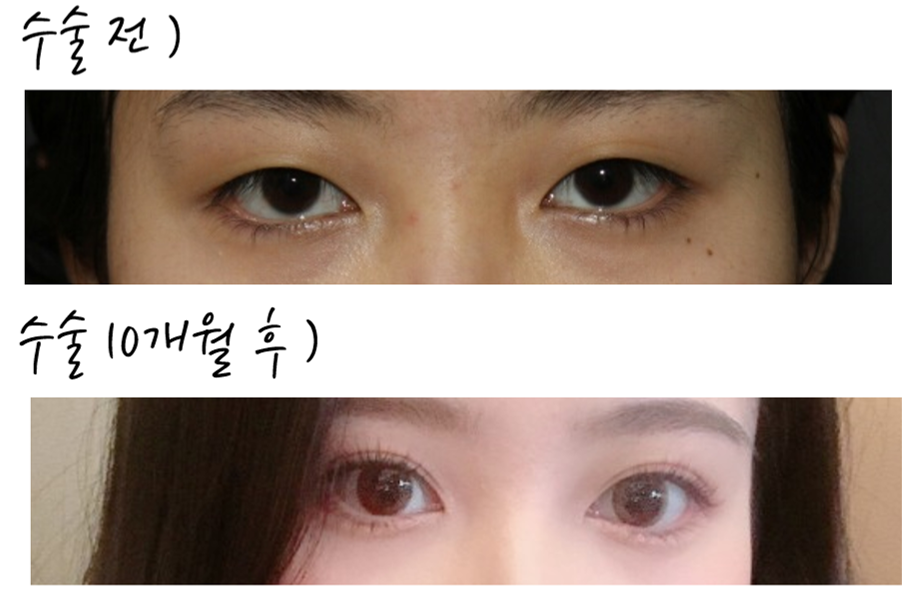 전 이미지