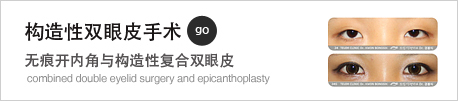 구조적쌍꺼풀수술